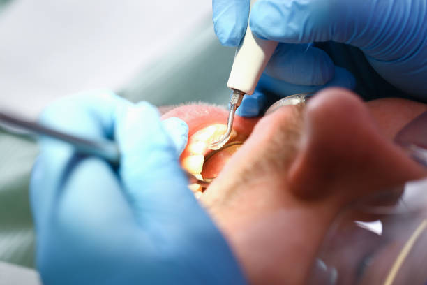 Best Dentist for Tooth Abscess  in Pembroke Pines, FL