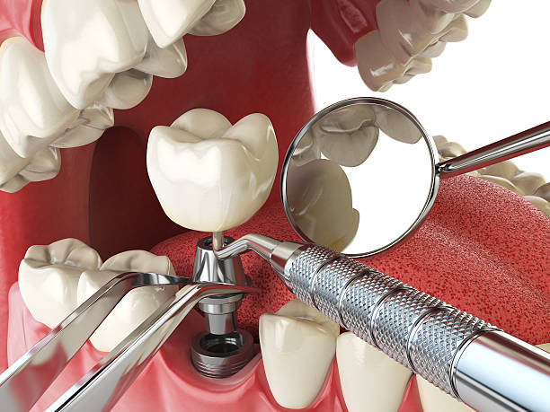 Best Urgent Tooth Repair  in Pembroke Pines, FL
